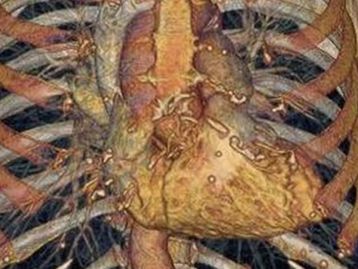 Nova máquina de tomografia computadorizada produz imagens impressionantes