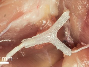 Impressões 3D estão ajudando a revolucionar a medicina