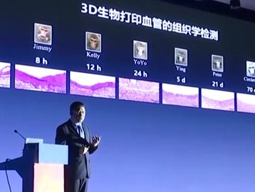 Cientistas implementam com sucesso vasos sanguíneos 3D em macacos 