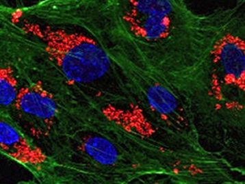 Nanopartículas podem diminuir taxa de rejeição em transplante de órgãos