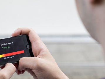 Aplicativo detecta câncer pancreático analisando o branco dos seus olhos