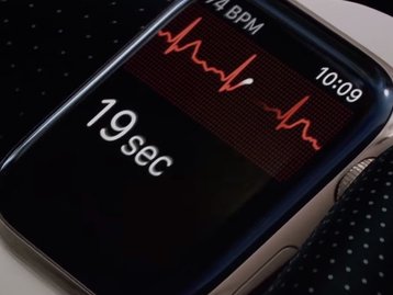 Eletrocardiograma do Apple Watch 4 começa a funcionar hoje