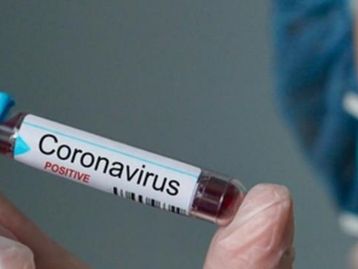Cientistas brasileiros estão criando vacina contra o Covid-19