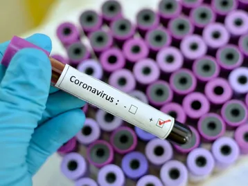 “Troll” quase barrou fabricação de testes do coronavírus nos EUA