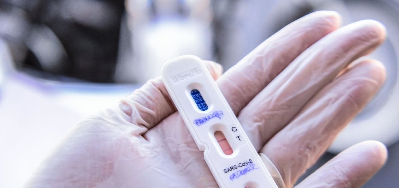 Anvisa permite que farmácias façam testes rápidos de covid-19