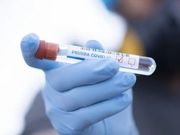 Governo libera uso da cloroquina em casos leves de covid-19