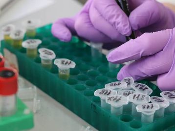 Estudo revela proteínas que ajudam a prever gravidade de covid-19