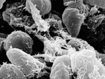 Novos casos de peste bubônica acendem alerta na China