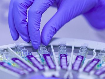 Covid-19: hospital da USP examina 28 suspeitos de reinfecção