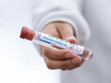 Coronavírus: voluntário em testes da vacina de Oxford morre no Brasil