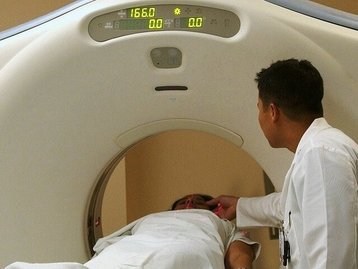 Inteligência artificial consegue prever risco de câncer de pulmão