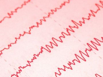 Canto de pássaro é recriado com leitura de sua atividade cerebral