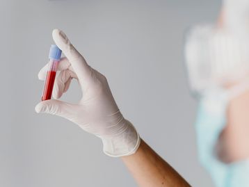 Novo exame de sangue pode detectar tumor cerebral em estágios iniciais