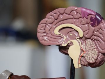 Alzheimer: descoberta forma mais agressiva e precoce da doença
