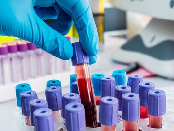 Check-up #2: testes de sangue para câncer e o dano das queimadas à saúde