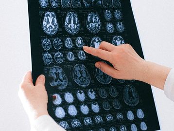 Cientistas criam primeiro atlas detalhado do cérebro humano