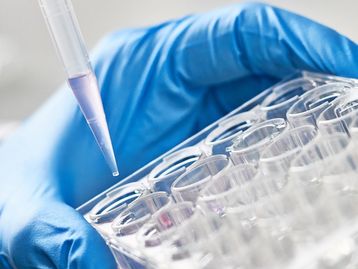 Pesquisa descobre genes que podem causar ou inibir obesidade