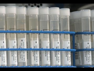 Câncer de próstata: FDA aprova teste que avalia risco genético para doença