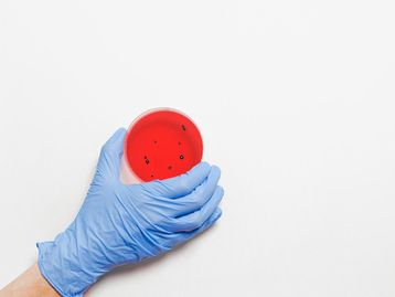 'Super bactérias' matam 1,2 milhão de pessoas por ano, mostra estudo