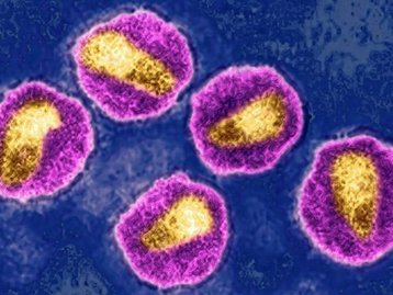 HIV: variante mais transmissível do vírus circula na Europa, diz pesquisa