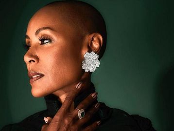 O que é alopecia? Saiba mais sobre a condição da atriz Jada Pinkett Smith