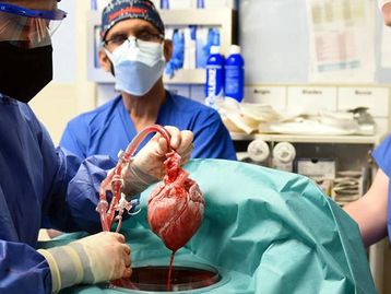 Transplantado com coração de porco pode ter morrido por vírus suíno