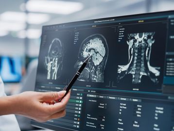 Diabetes tipo 2 pode causar perdas cognitivas nos mais velhos, diz estudo 