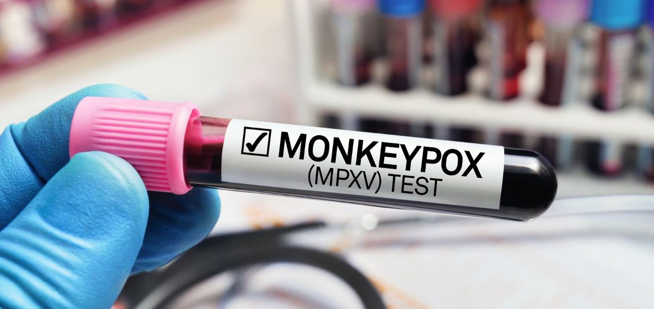 O que sabemos e não sabemos sobre o Monkeypox, a varíola de macaco