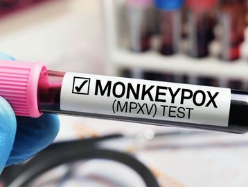 O que sabemos e não sabemos sobre o Monkeypox, a varíola de macaco