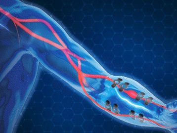 Cientistas criam tatuagem de grafeno que monitora pressão arterial