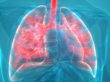 Qual a diferença entre pneumonia bacteriana e viral?
