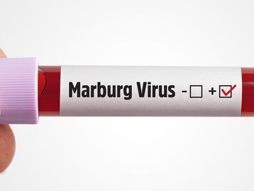 Gana confirma duas mortes causadas pelo vírus Marburg