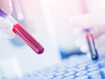 Exame de sangue consegue prever risco de leucemia, diz estudo