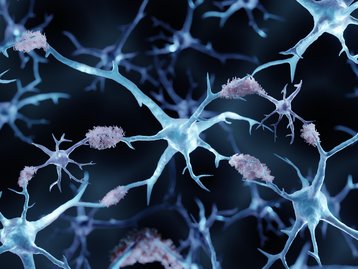 Estudo afirma que dois vírus podem desencadear Alzheimer
