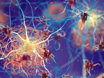 Chance de pessoas mais velhas terem Alzheimer aumenta até 80% após covid-19