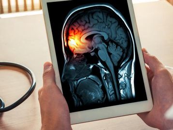 Meningite: como é a prevenção e o tratamento da doença?