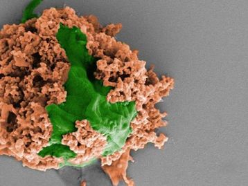 Conheça os microrrobôs capazes de tratar pneumonia mortal!