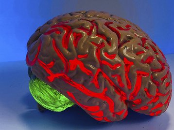 Ex-presidente da Neuralink abre startup rival para competir com Elon Musk