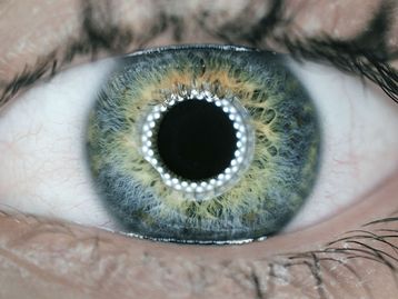 Lente de contato inteligente é capaz de detectar e tratar glaucoma