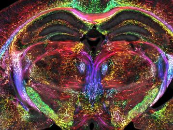 Ressonância magnética 'turbinada' cria imagem milhões de vezes mais nítida