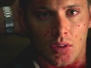 Quantas vezes Dean Winchester morreu em Supernatural?