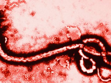 EUA irá criar robôs para minimizar riscos de infecção pelo vírus ebola
