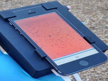 Cientistas transformam iPhone em detector de parasitas sanguíneos