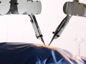 A primeira microcirurgia assistida por mãos robóticas foi um sucesso