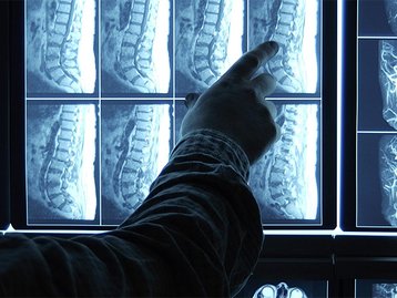 Philips está desenvolvendo algoritmos e IAs para diagnosticar câncer