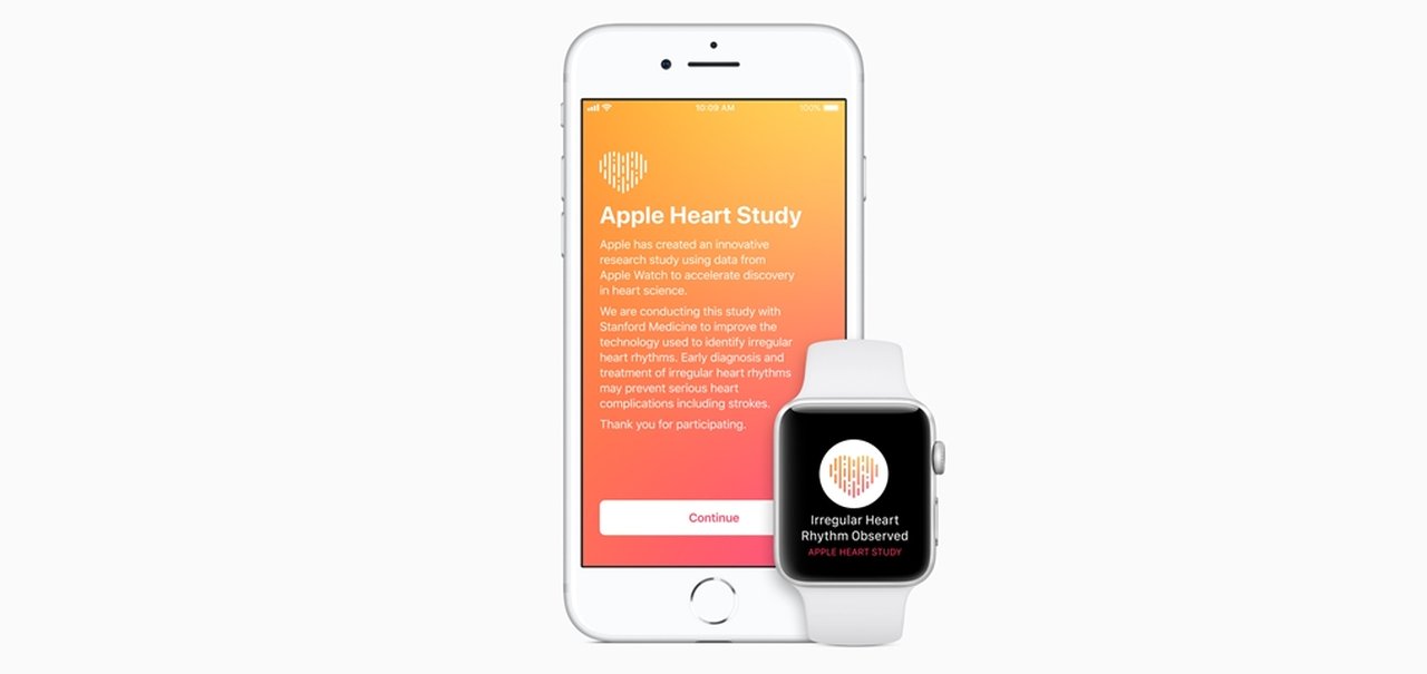 Apple Watch pode identificar alterações de ritmo cardíaco, mostra estudo