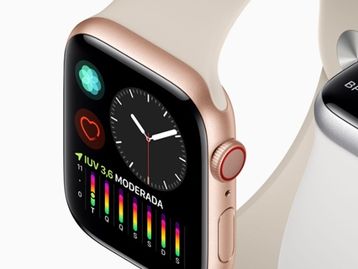 Brasileiro descobre taquicardia graças ao Apple Watch