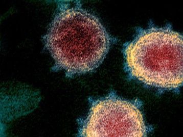 SARS-CoV-2: imagens mostram o vírus atacando uma célula