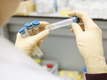 Estudo com cloroquina é interrompido após mortes de pacientes
