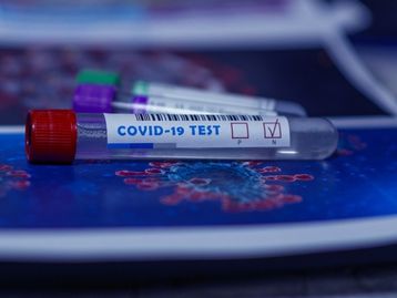 Teste rápido de covid-19 chega a farmácias brasileiras por R$ 130